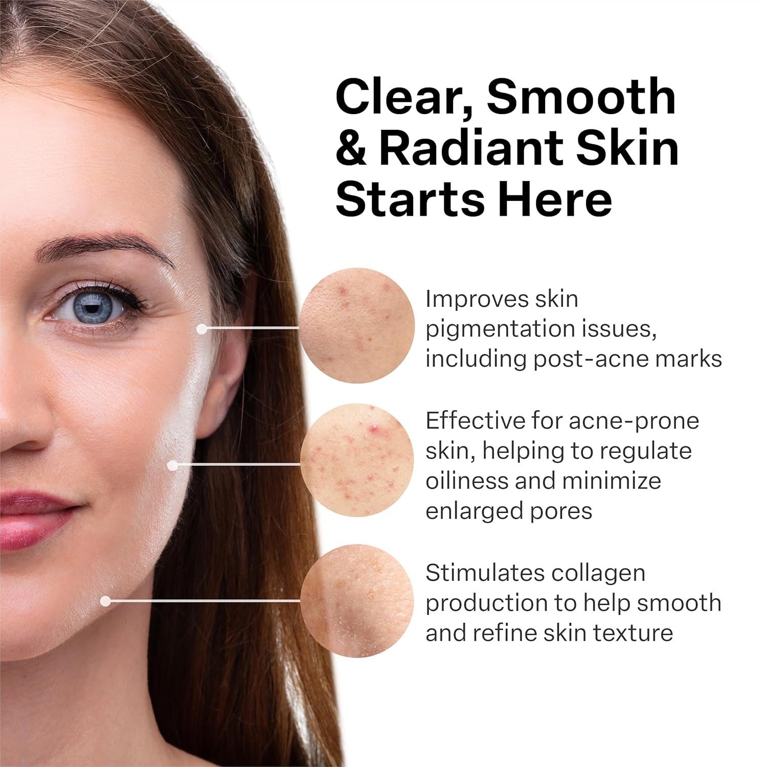 A313 French Pharmacy Vitamin A (Retinoids) Lightweight Face Cream for Anti-Aging, Reduce Wrinkles, Prevents Acne Breakouts, and Hyperpigmentation - Skincare for Smooth, Radiant Skin - 50g Cream - Image 3